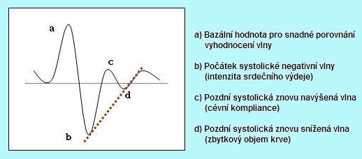 sinusoida